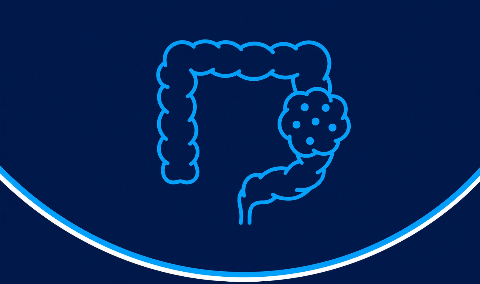 colorectal cancer, colon cancer treatment, cancer specialist, chemotherapy colorectal