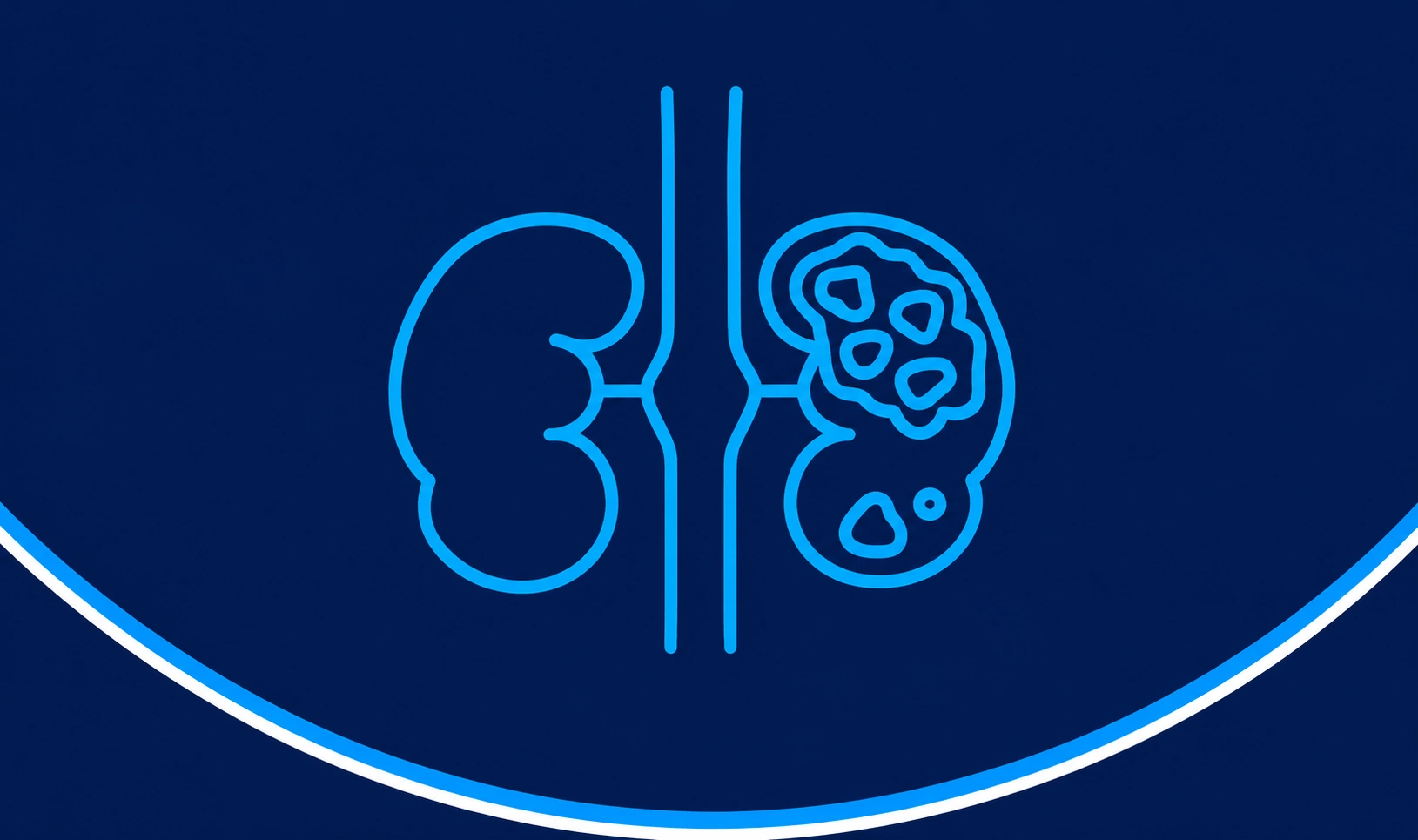 kidney cancer, renal cell cancer, cancer treatment, targeted therapy kidney