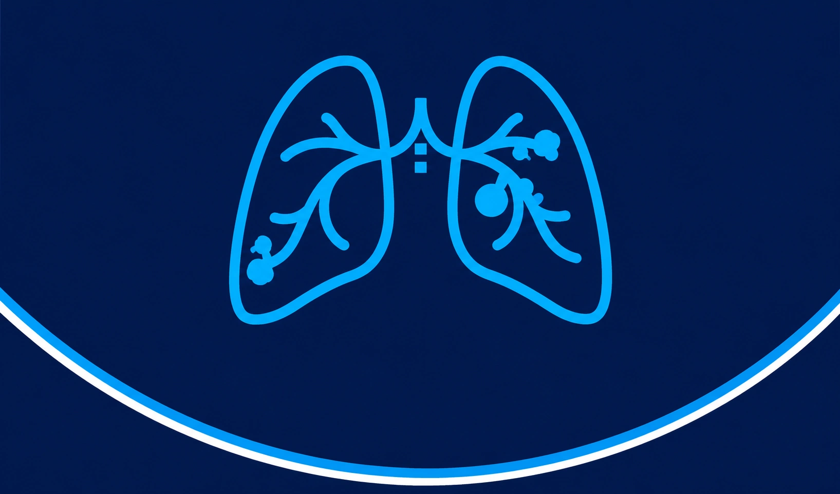 lung cancer, lung cancer treatment, oncologist, chemotherapy lung cancer