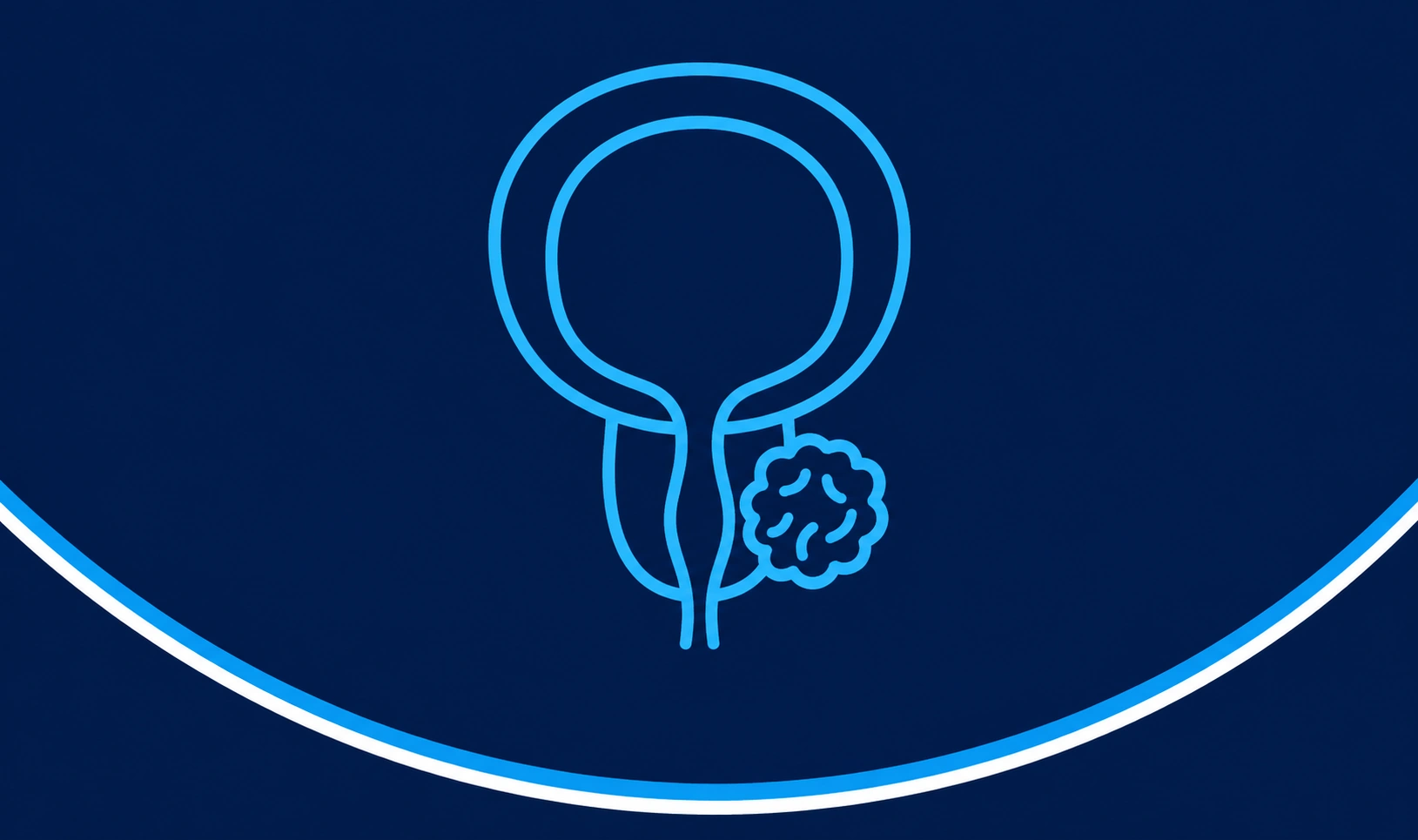 prostate cancer, prostate cancer treatment, male cancer, oncologist